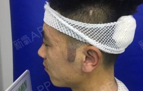 鬓角是什么 鬓角是什么意思