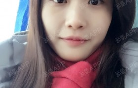 韩式三点 韩式三点双眼皮能维持几年