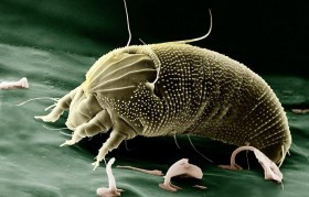 头皮螨虫 头皮螨虫的症状