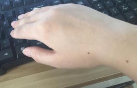 手背有痣的女人 手背有痣的女人图解