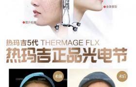 什么是热玛吉 医美热玛吉是什么东西