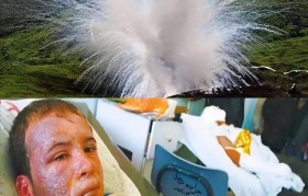 白磷着火点 白磷被点燃的化学方程式