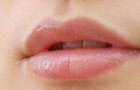嘴角暗沉 嘴角暗沉是什么原因