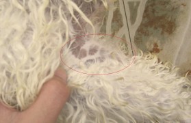 身上长黑斑图片 身上长黑斑图片 癌症