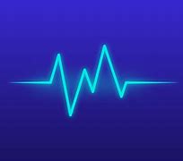 心电图图片 心电图图片位置图