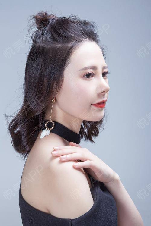 隆鼻 隆鼻有什么危害和后遗症吗