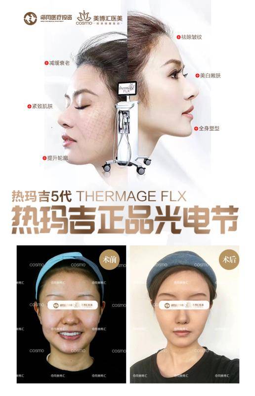 什么是热玛吉 医美热玛吉是什么东西