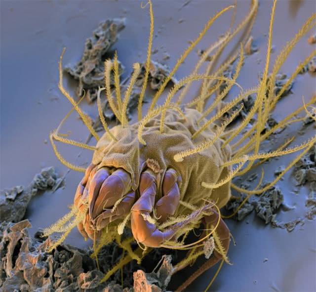 头皮螨虫 头皮螨虫的症状