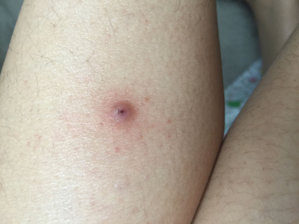 长包 长包里面硬硬的是什么