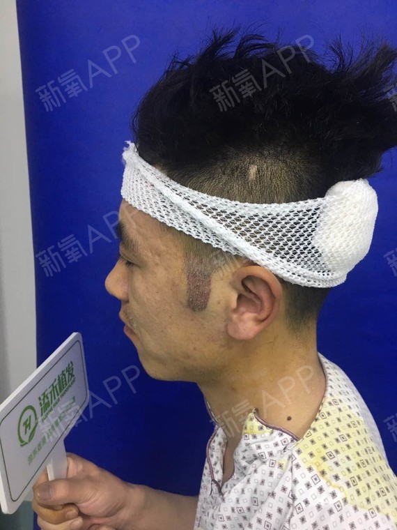 鬓角是什么 鬓角是什么意思