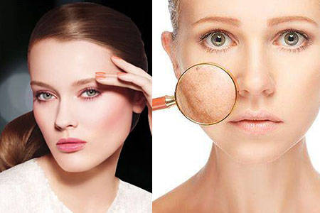 祛斑技巧 祛斑日常方法