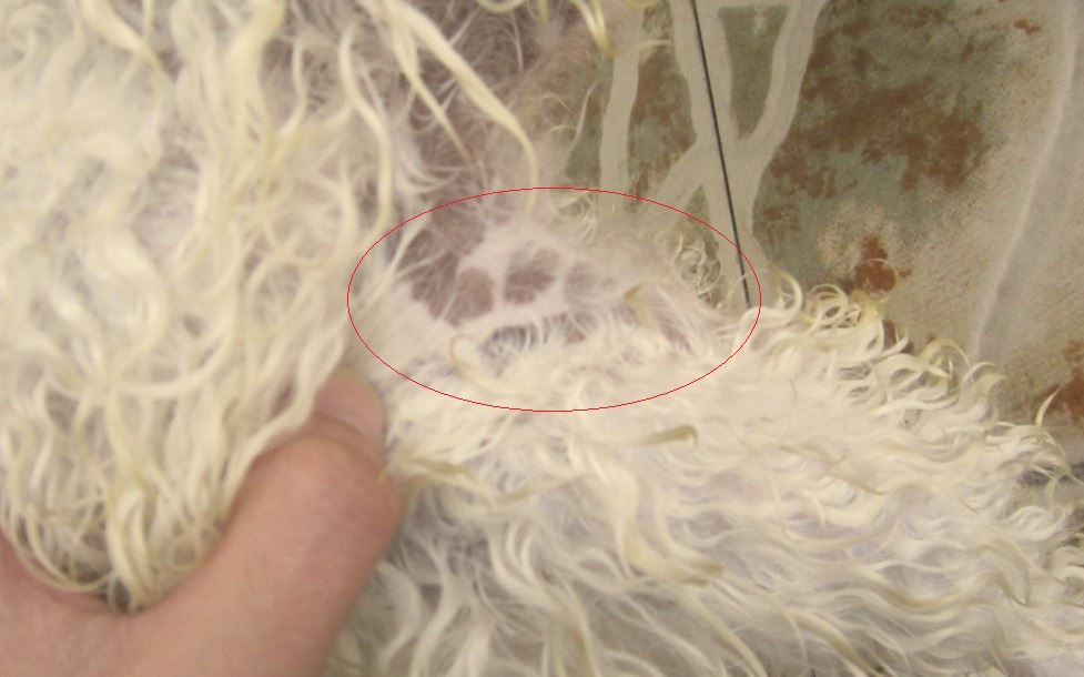 身上长黑斑图片 身上长黑斑图片 癌症