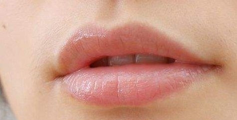 嘴角暗沉 嘴角暗沉是什么原因 嘴角暗沉 嘴角暗沉是什么原因