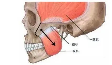 咀嚼肌 咀嚼肌疼痛张不开嘴的原因