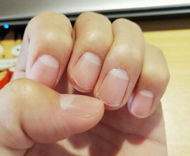 指甲上的月牙代表什么的简单介绍